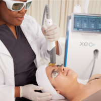 CUTERA XEO+